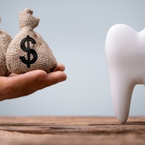 how-much-do-dental-implants-cost-factors-affecting-the-price-00